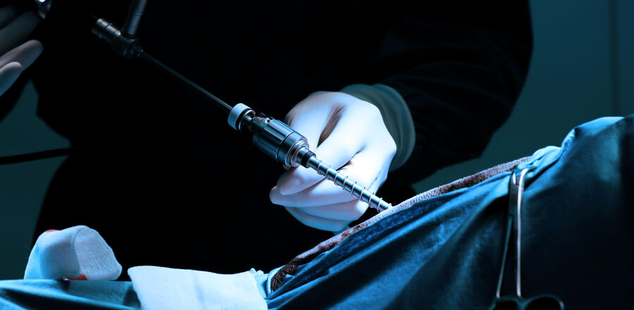 Why Laparoscopic Surgery Is Becoming the Gold Standard in Modern Medicine
