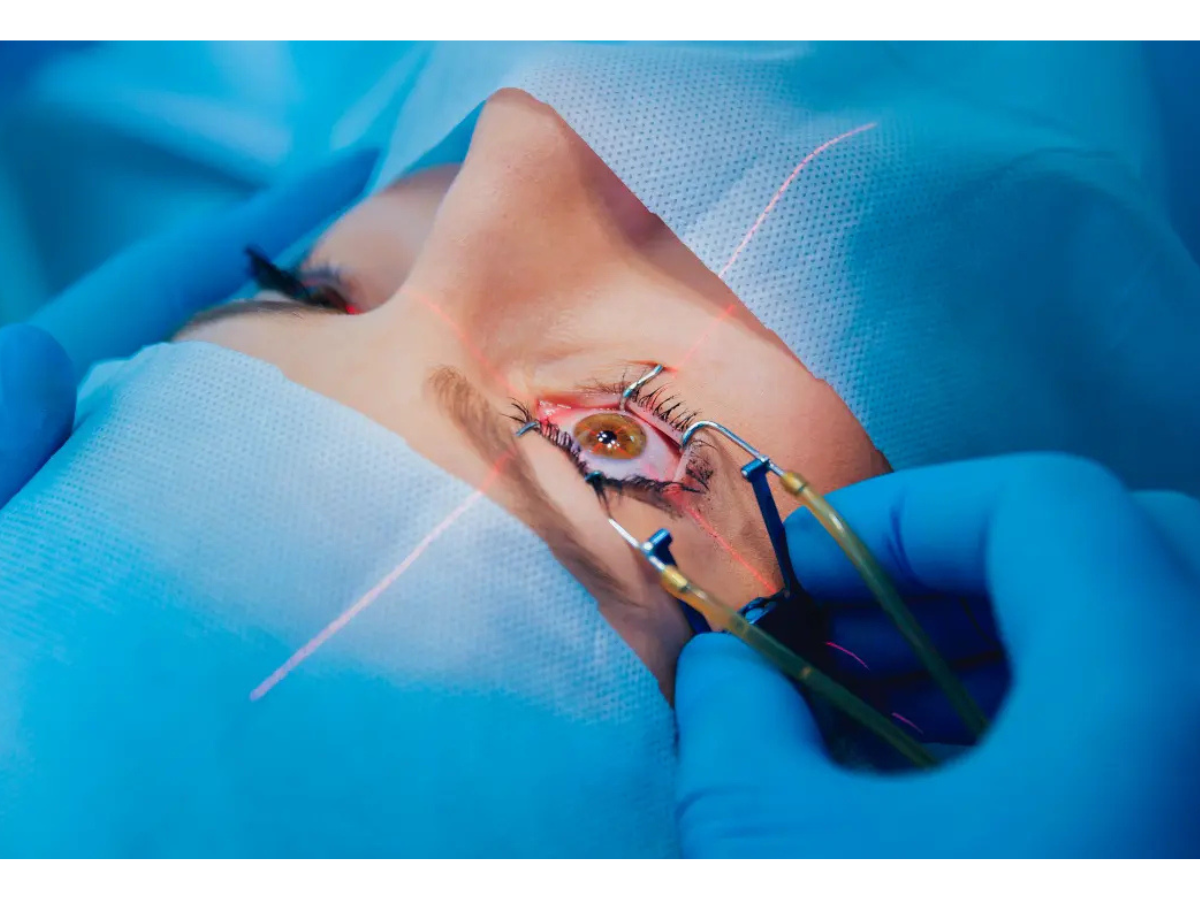 _Bladeless Lasik