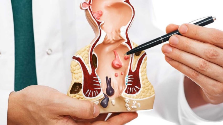 Common-causes-of-anal-or-rectal-pain-and-how-to-treat-them
