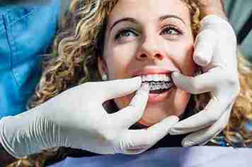 Invisalign Treatment Comfort and Results for Patients_11zon