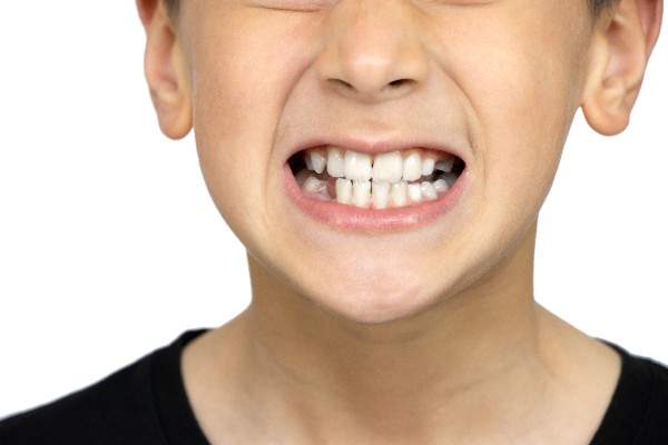 Teeth Whitening Dentist