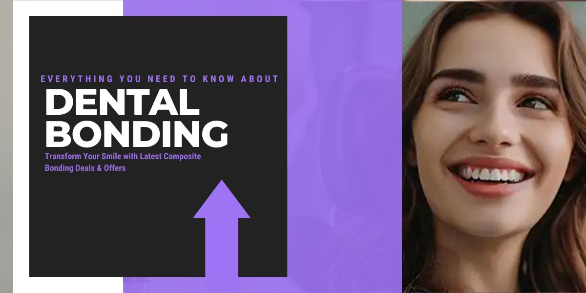 Everything You Need to Know About Dental Bonding