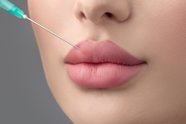 Russian Lip Fillers in Dubai: A Step-by-Step Guide to the Treatment Process