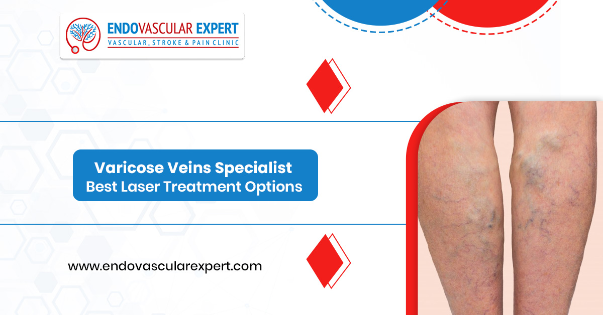 Dr. Nikhil Bansal performing laser treatment for varicose veins in Jaipur