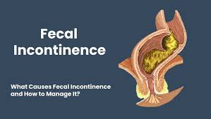 Effective Treatment of Fecal Incontinence in Thrissur – Expert Care by Dr. Raviram S. at Thrissur Piles Clinic
