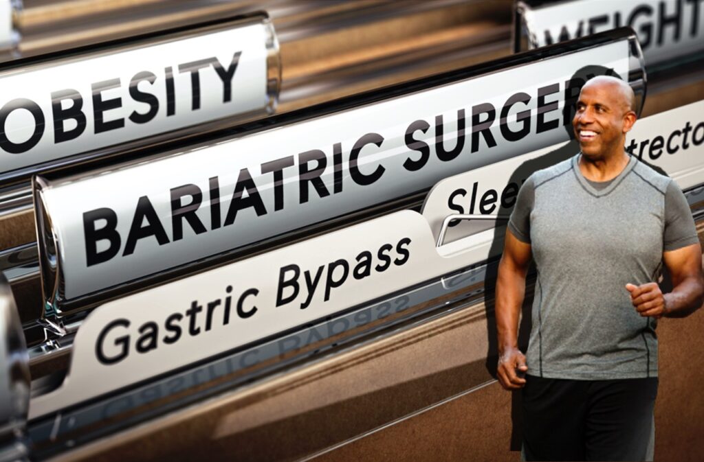 gastric-sleeve