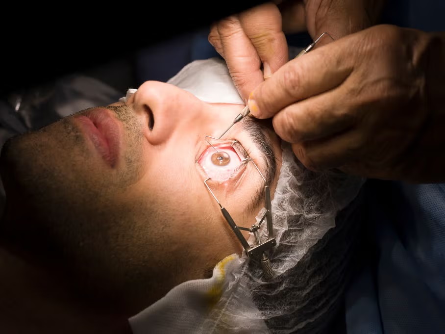 LASIK Surgery