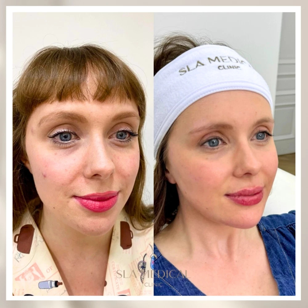 Remove Dark Spots Safely: Pigmentation Solutions in Manchester