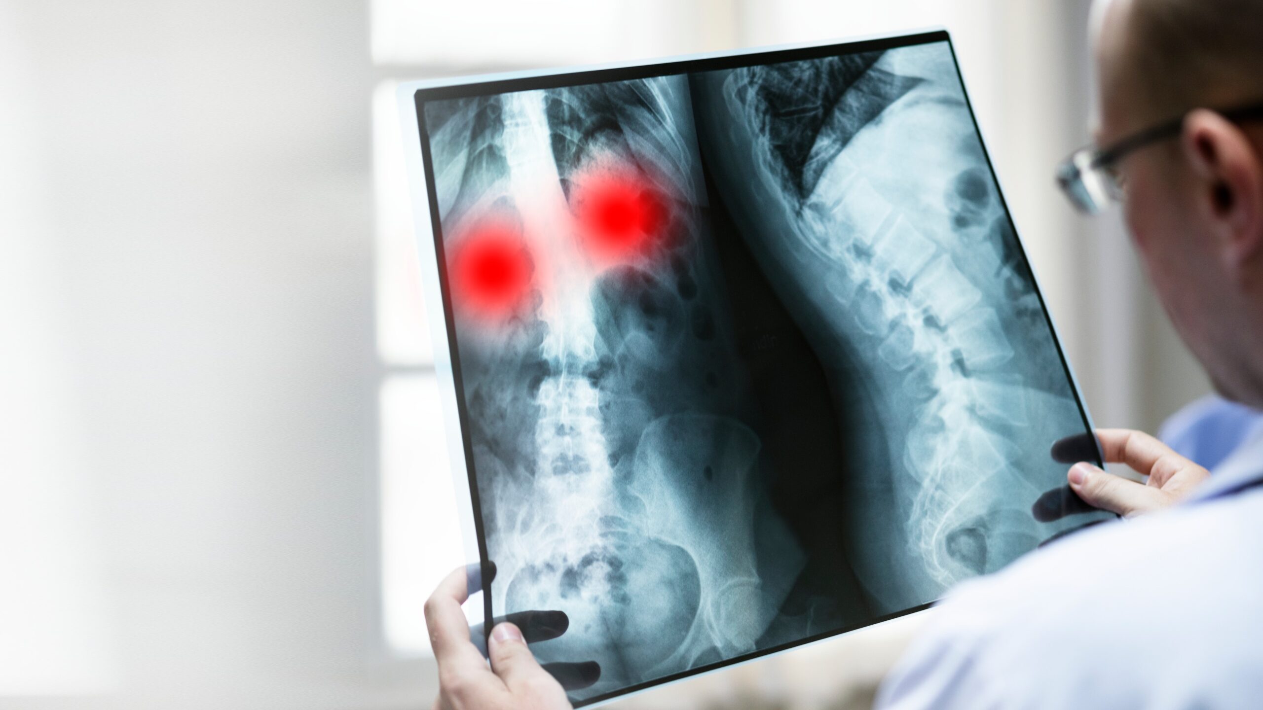 What You Need to Know About MRI Shoulder Near Me: Procedure, Cost, and Benefits