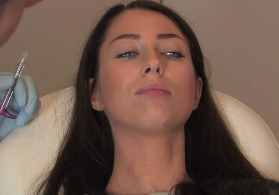 Lippen aufspritzen – Alles, was Sie wissen müssen