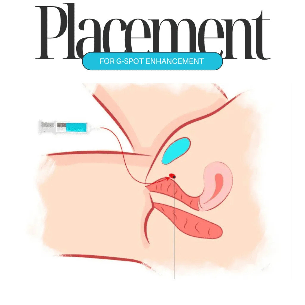 G-spot-Enhancement-in-Dubai