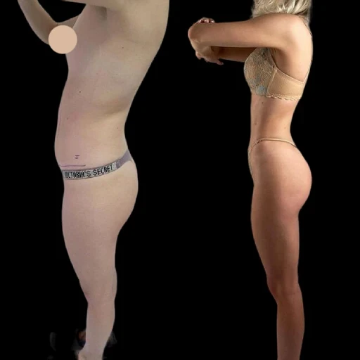 J-Plasma Breakthroughs: Treatments by the Best Doctors in Dubai