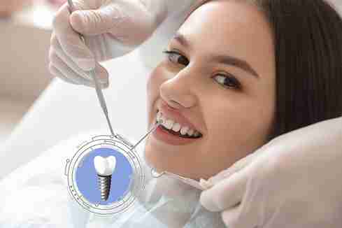 Revolutionary Same-Day Dental Implants for a Quick Smile Fix
