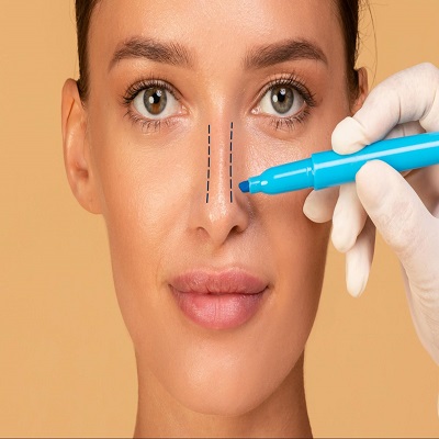 Rhinoplasty-in-Riyadh-4