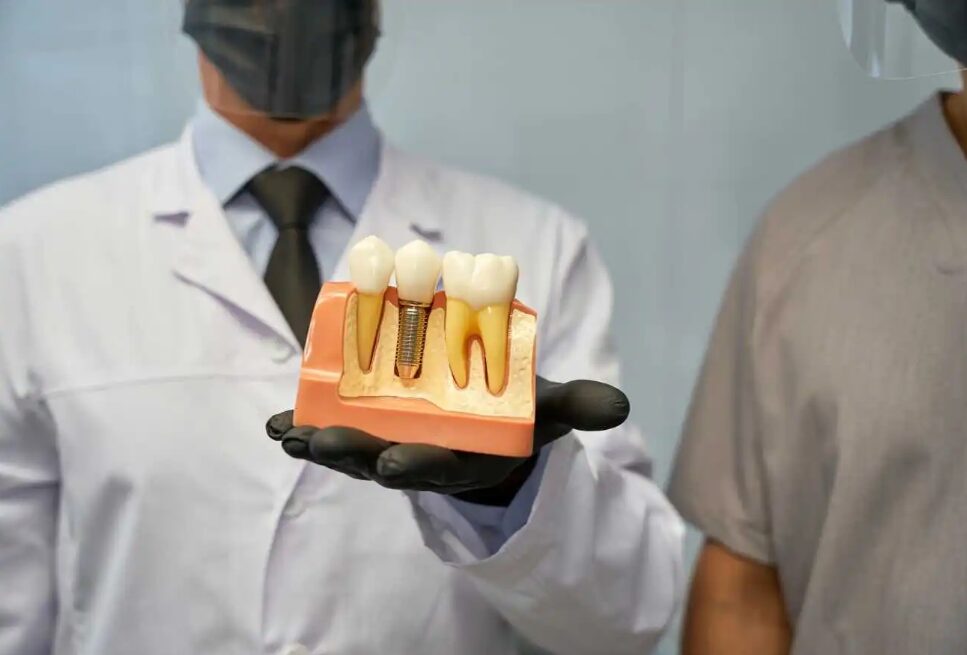 Dental Implant Cost in Mississauga: What Patients Should Know Before Committing