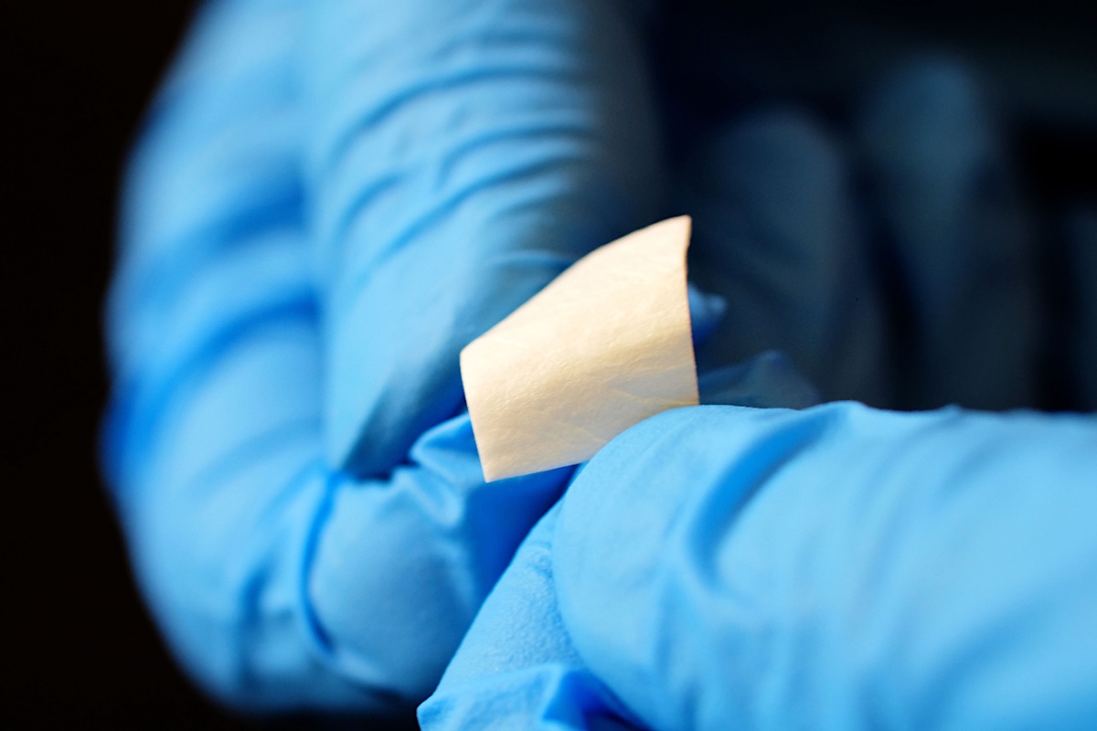 What-is-an-Allograft