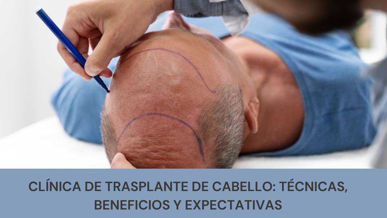 Clínica de Trasplante de Cabello: Técnicas, Beneficios y Expectativas