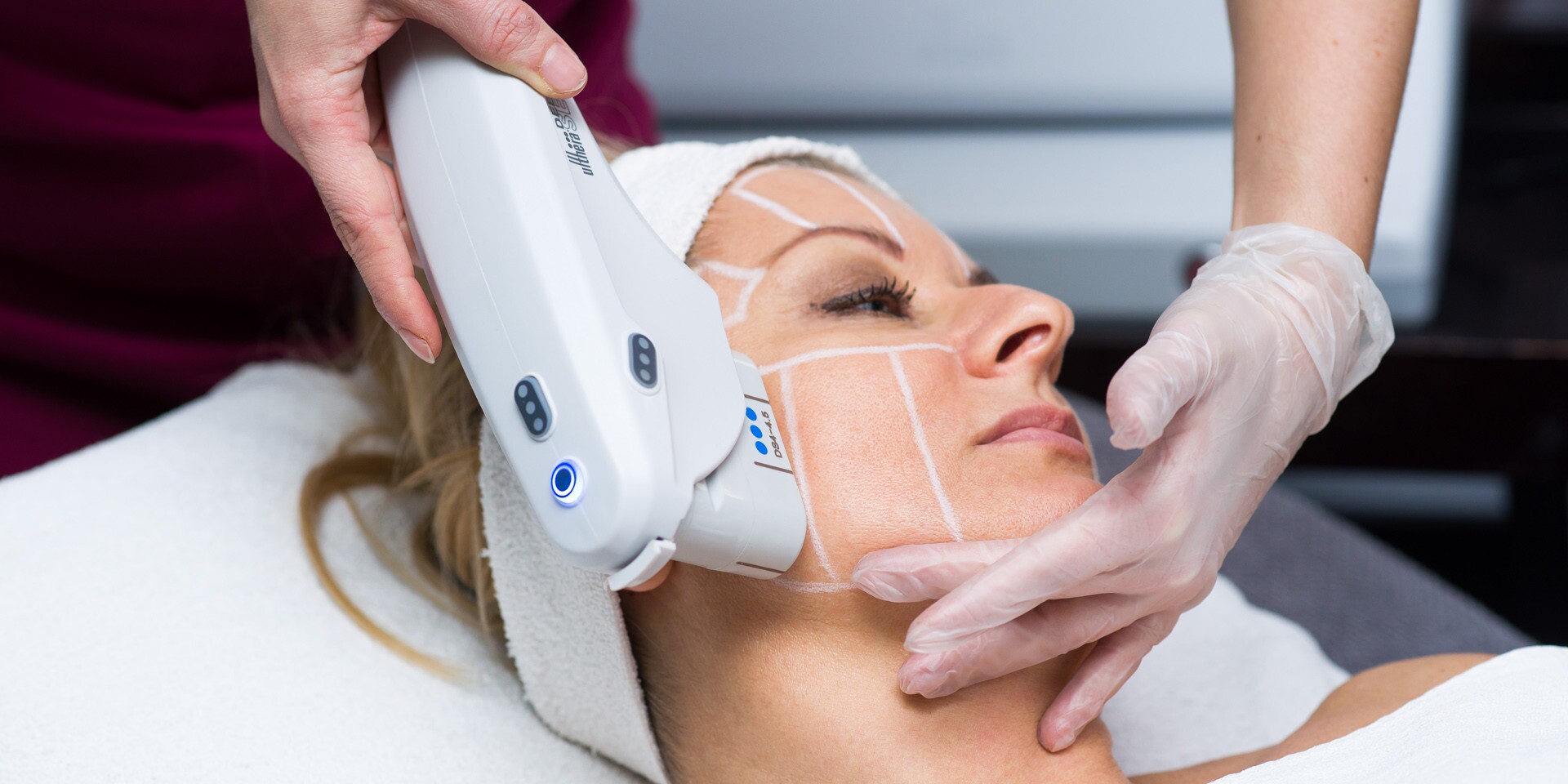 Laser Hair Removal in Islamabad for Permanent Hair Reduction