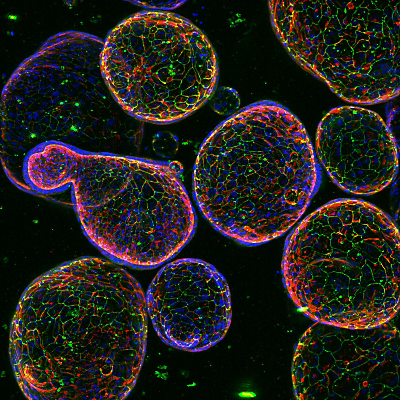 Why Spheroid Culture Matters in Tumor Biology Studies