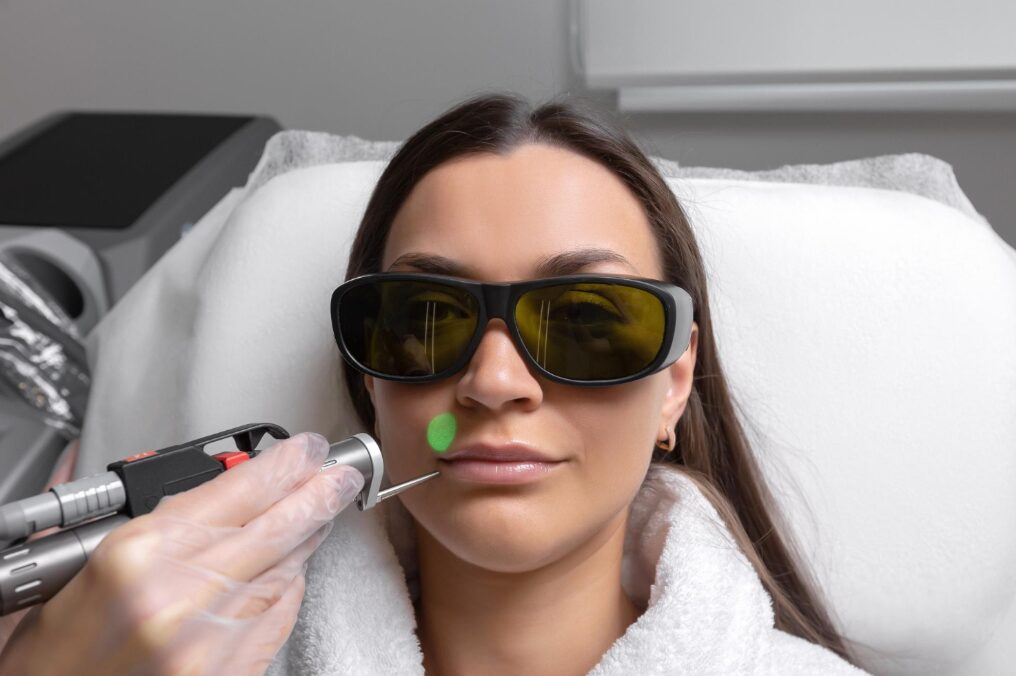 Minimize Fine Lines and Reversing Aging With CO2 Laser in Manchester