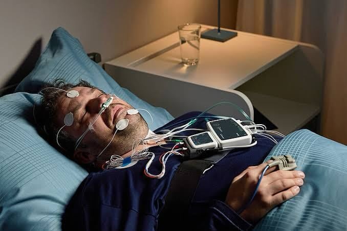 Polysomnogram-level-1-1