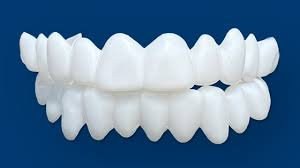 Transform Your Smile: Benefits of Composite Veneers Explained