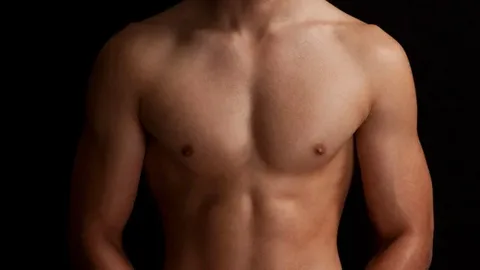 Gynecomastia in Islamabad: Common Myths and Facts