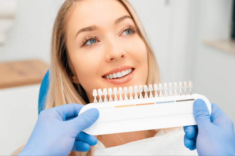 Veneers in Dubai: How the Procedure Works and Who Can Get It