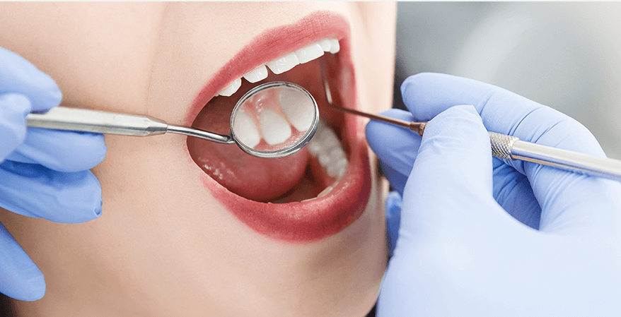 Dental Hygienist Advice: How to Prevent Cavities