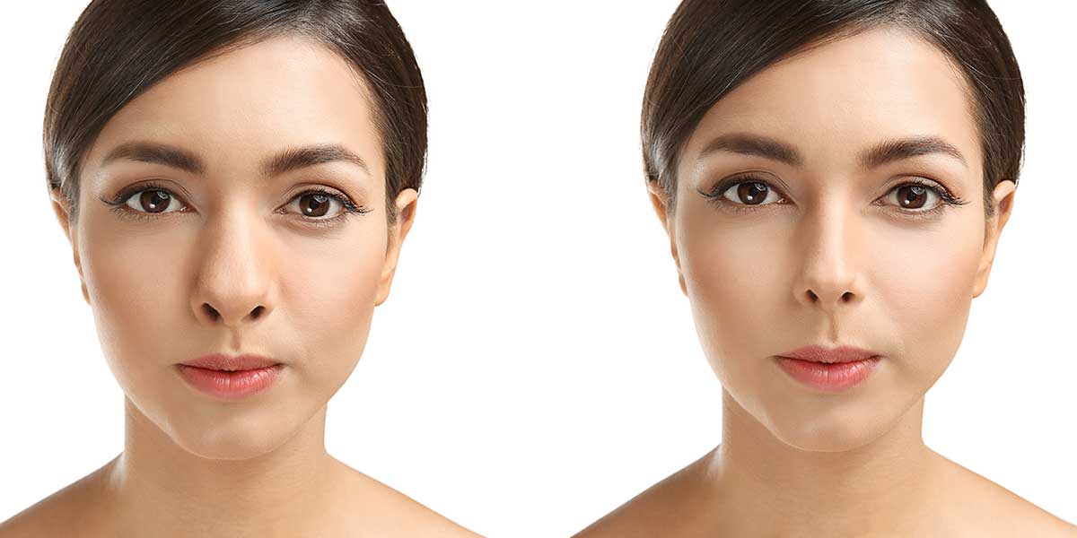 Transform Timeless Structure Beautifully Through Rhinoplasty