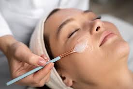How to Prepare Your Skin Before a Chemical Peel in Islamabad