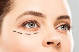Blepharoplasty vs. Non-Surgical Eye Treatments: Pros and Cons