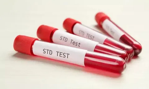 Frequently Asked Questions About STD Test in Dubai Answered
