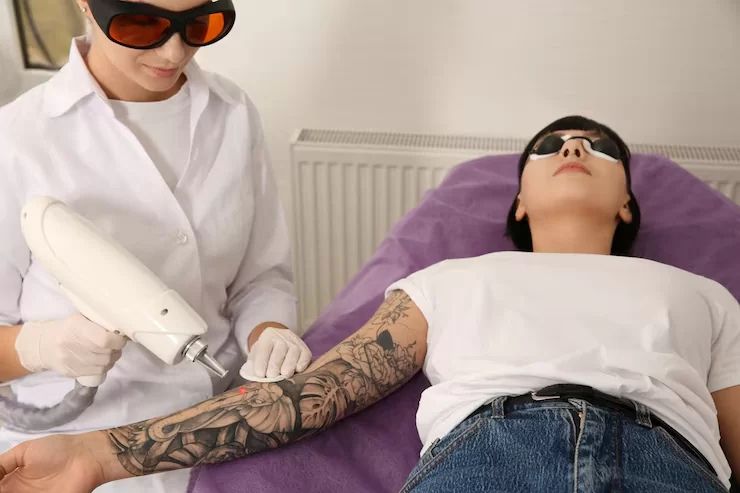 Why Cheap Laser Tattoo Removal Can Cost You More in the Long Run?
