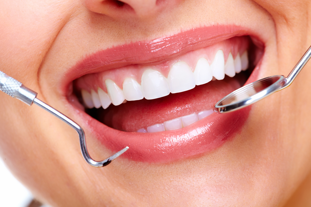 Dental Tooth Filling Dubai: Restore Your Teeth with Precision Care