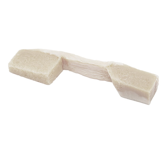 Why Amniotic Membrane Grafts Are a Preferred Choice for Wound Healing