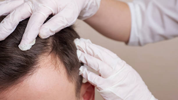 Best Skin & Hair Clinic in Faridabad – Advanced Dermatology and Hair Transplant Care
