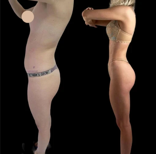 Personalized J-Plasma Skin Treatments by the Best Doctors in Dubai