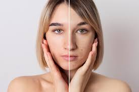 How to Identify Dark Spots and Pigmentation on Your Skin