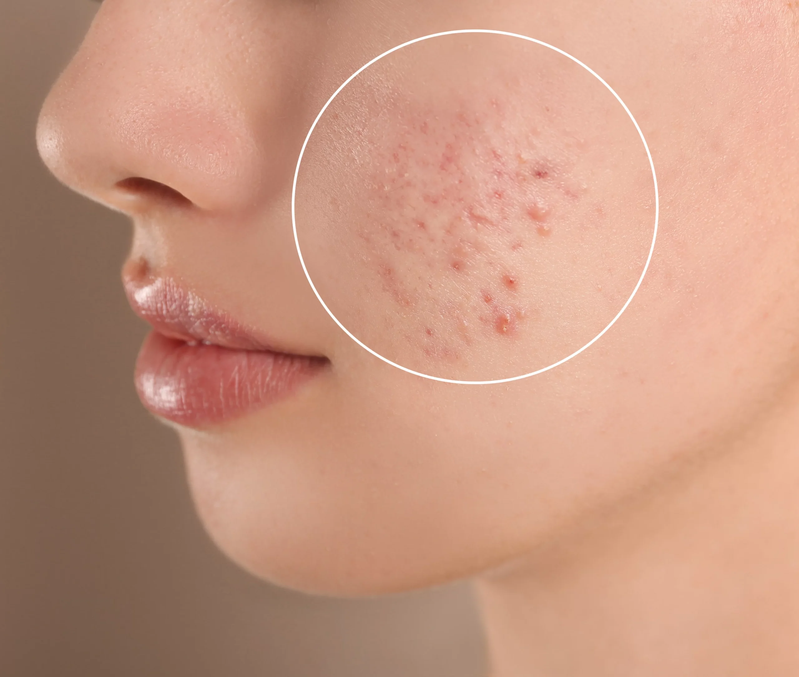 Best Dermatologist in Jaipur for Acne, Hair Loss & Skin Treatments