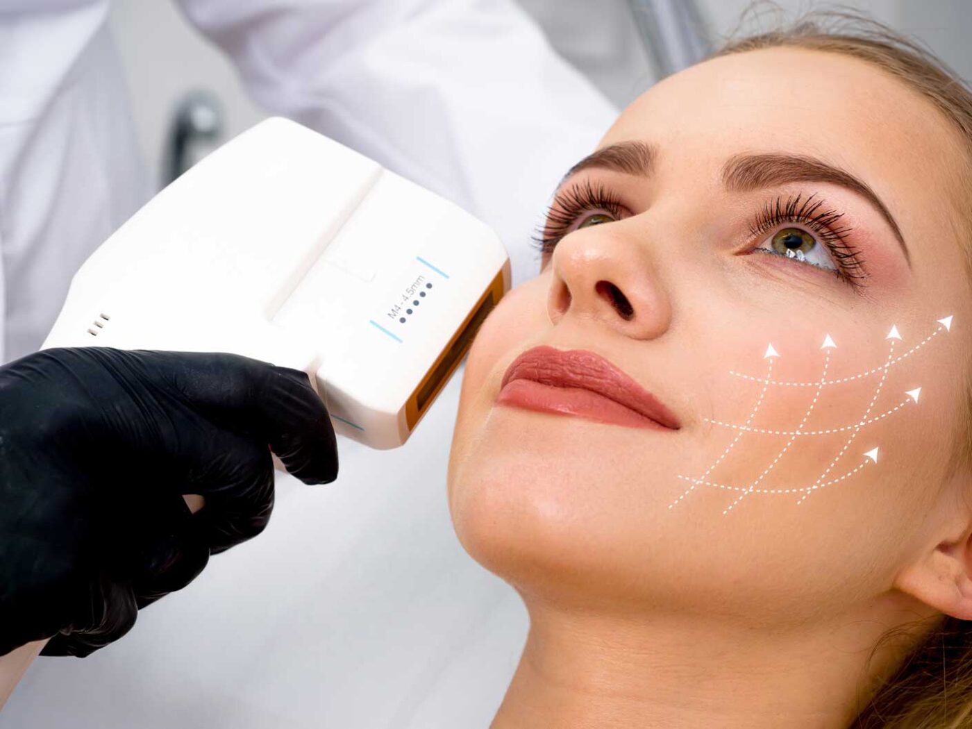 Can HIFU Treatment in Dubai Elevate Skin Smoothness for a Brighter Glow