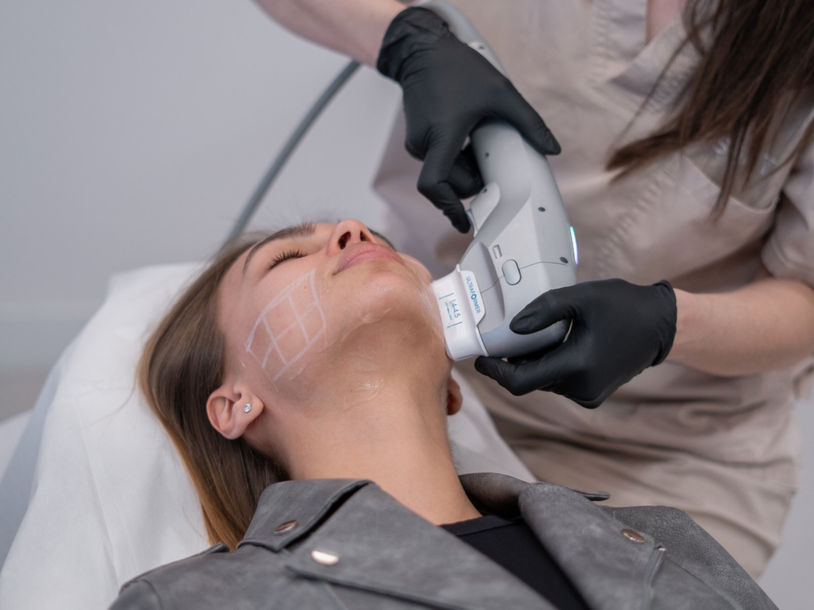 Can HIFU Treatment Transform Facial Skin Tone With Radiance Boost