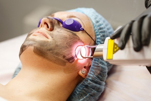 What Is Pico Laser Treatment? A Guide to This Advanced Skin Technology