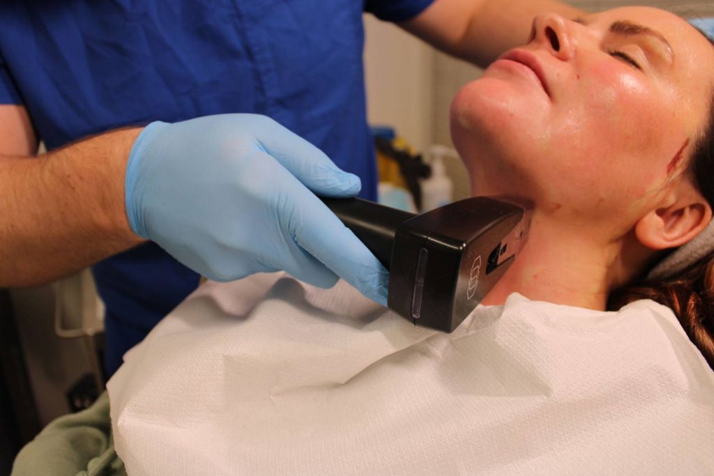 Is Morpheus8 Treatment the Key to Firm and Healthy Skin Daily