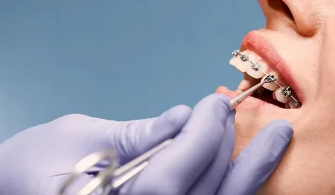 5 Ways Orthodontic Treatment Can Improve Your Confidence and Health