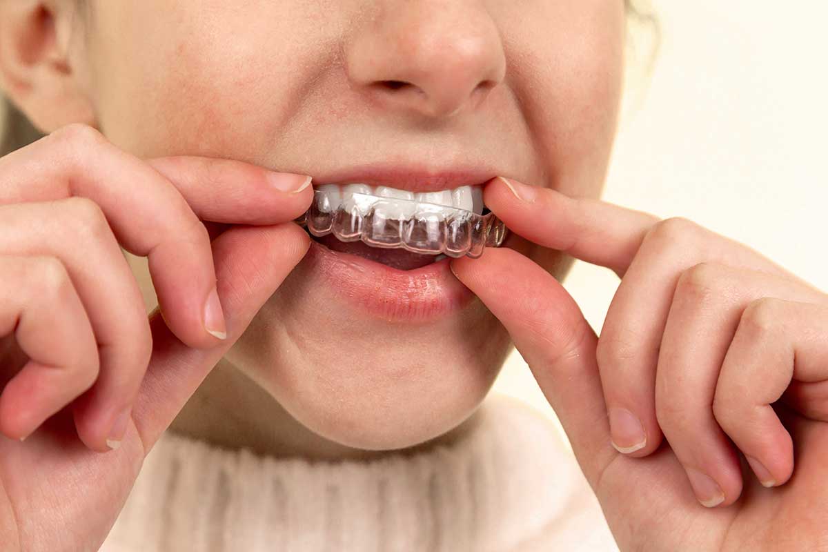 Emergency Situations That Require Immediate Attention from a Dentist