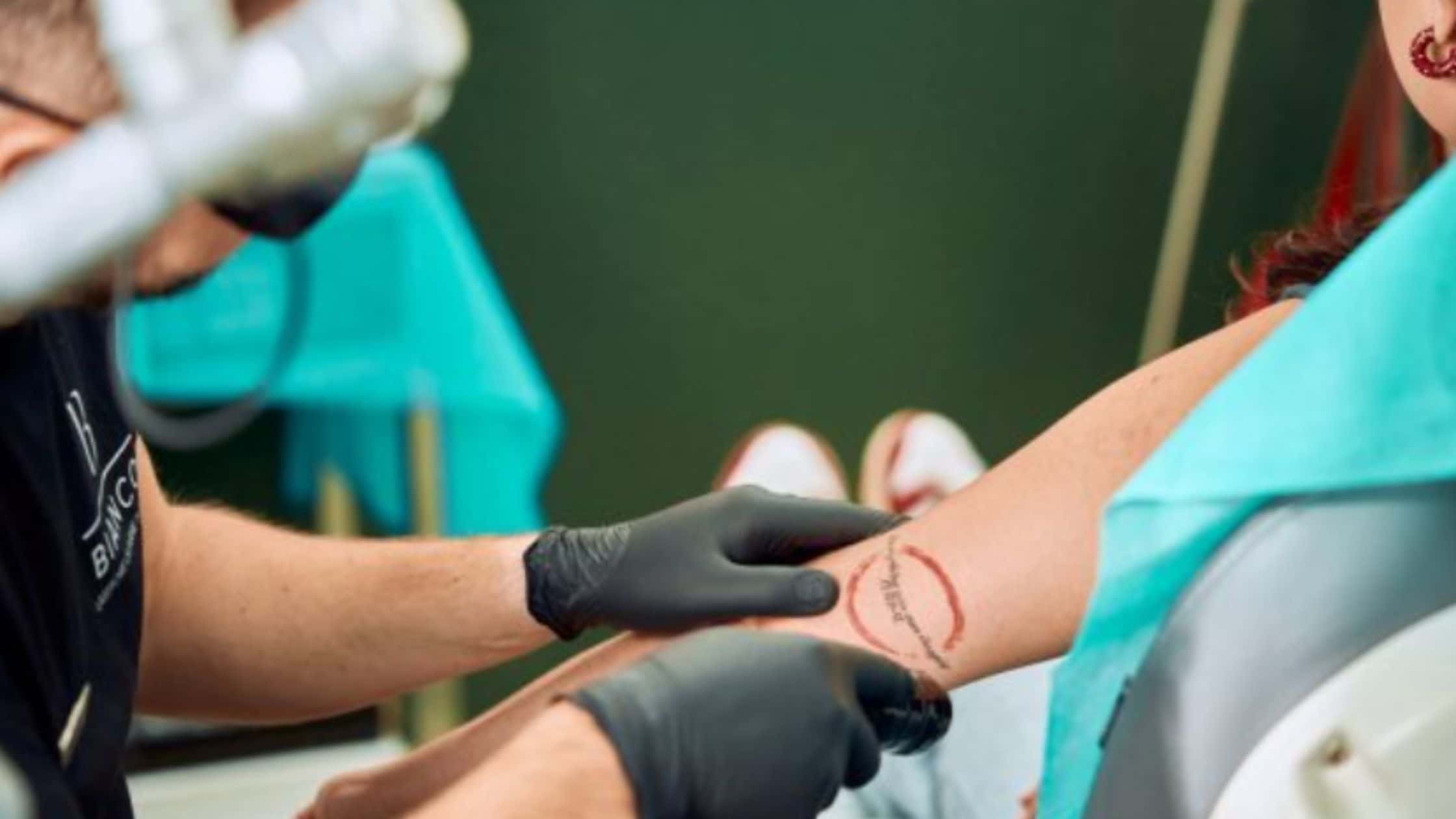 Jak usunąć tatuaż i jakie metody oferuje profesjonalne studio usuwania tatuażu?