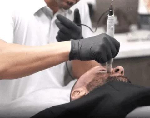 Smooth, Confident Grooming With Hair Removal For Men in Randwick