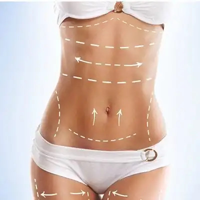 Top FAQs About 360 Body Contouring in Riyadh Answered by Experts