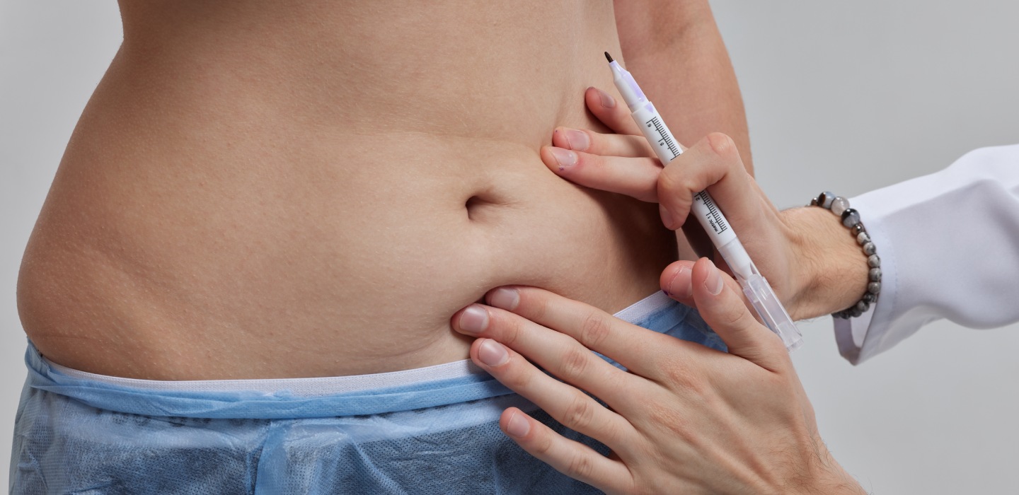 Can Fat Melting Injections Break Down Fat Naturally?